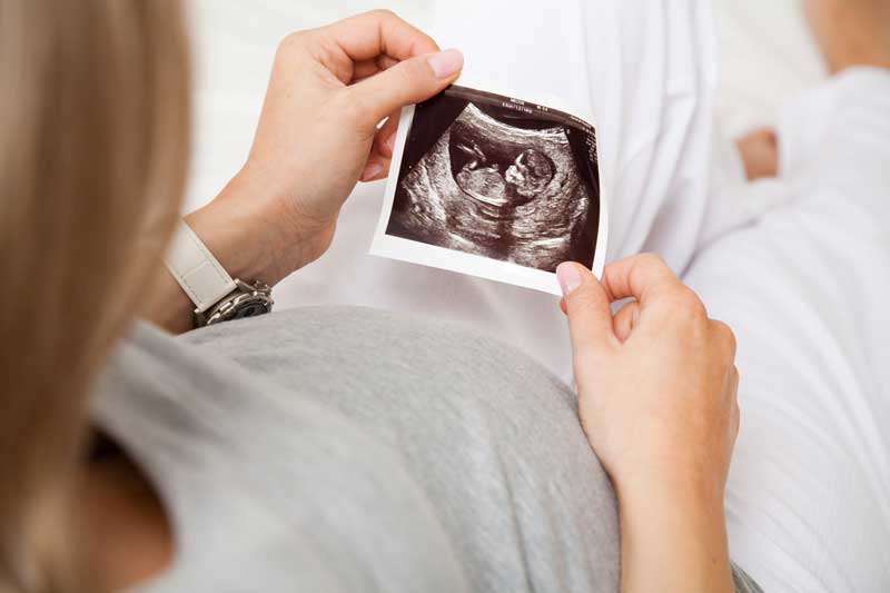 schwangerschaftsshooting ultraschall bilder